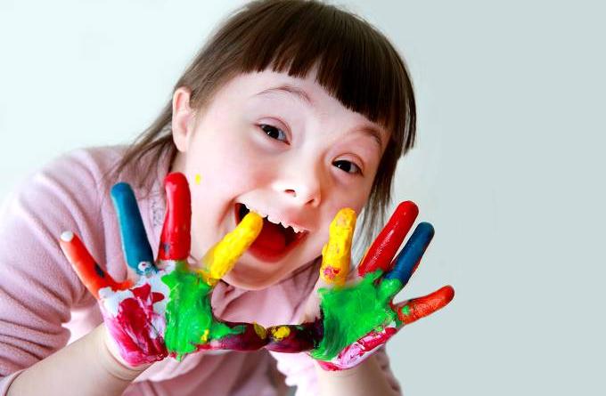 Menina com Síndrome de Down com tinta colorida nas mãos IStock/Getty Images